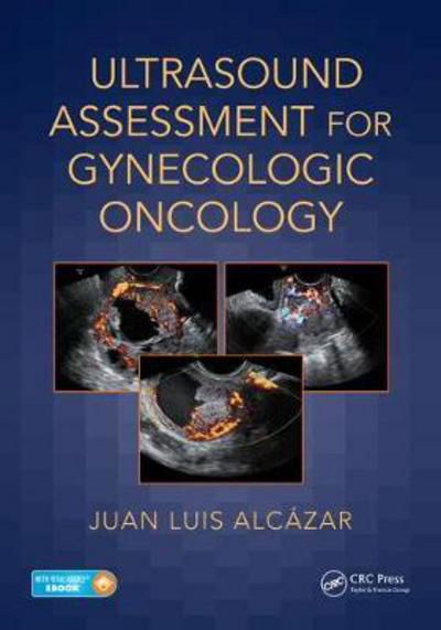 Cover for Alcazar, Juan Luis (University of Navarra, Pamplona, Spain) · Ultrasound Assessment in Gynecologic Oncology (Innbunden bok) (2018)