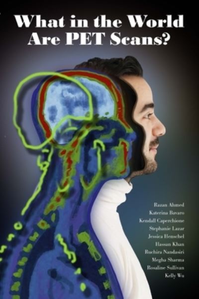 What in the World are PET Scans? - Austin Mardon - Książki - Golden Meteorite Press - 9781773692326 - 13 maja 2021