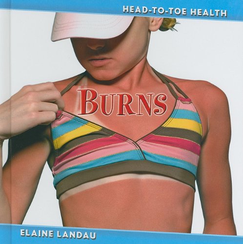 Cover for Elaine Landau · Burns (Head-to-toe Health) (Hardcover Book) (2011)