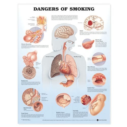 Cover for Anatomical Chart Company · Dangers of Smoking Anatomical Chart (Map) (2002)