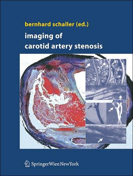 Cover for Bernhard Schaller · Imaging of Carotid Artery Stenosis (Hardcover Book) [2007 edition] (2007)