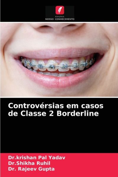 Cover for Dr Krishan Pal Yadav · Controversias em casos de Classe 2 Borderline (Paperback Bog) (2021)