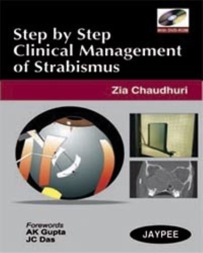 Cover for Zia Chaudhuri · Step by Step: Clinical Management of Strabismus (Book) (2008)