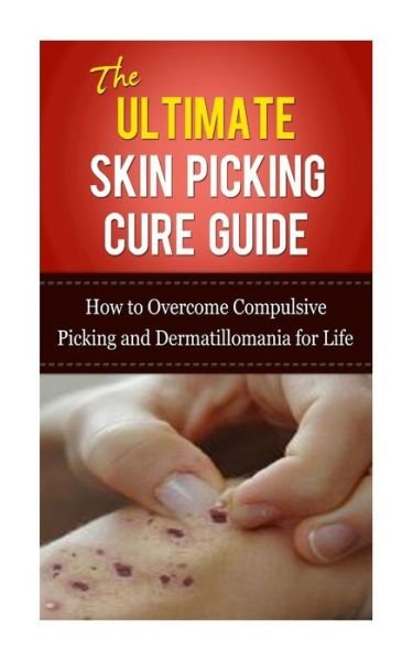 Cover for Caesar Lincoln · The Ultimate Skin Picking Cure Guide: How to Overcome Compulsive Picking and Dermatillomania for Life (Pocketbok) (2013)
