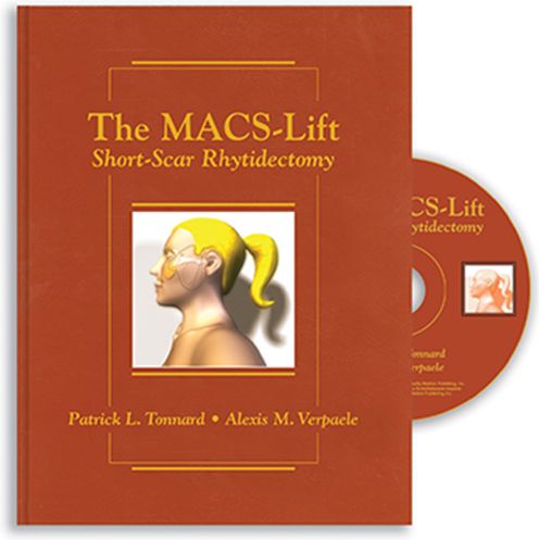 Cover for Tonnard, Patrick, MD · The MACS-Lift: Short-Scar Rhytidectomy (Hardcover Book) (2004)