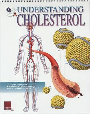 Cover for Scientific Publishing · Understanding Cholesterol Flip Chart (Spiral Book) (2006)