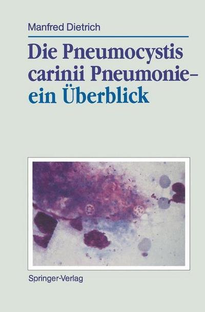 Cover for Manfred Dietrich · Die Pneumocystis Carinii Pneumonie- ein Uberblick (Taschenbuch) [German edition] (1989)