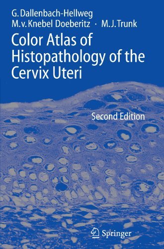 Cover for Gisela Dallenbach-Hellweg · Color Atlas of Histopathology of the Cervix Uteri (Taschenbuch) [Softcover reprint of hardcover 2nd ed. 2006 edition] (2010)