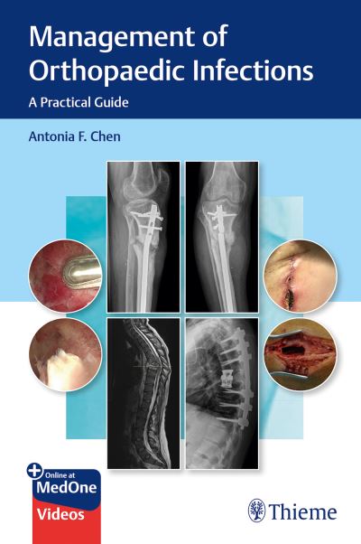 Cover for Antonia Chen · Management of Orthopaedic Infections: A Practical Guide (Book) [New edition] (2021)