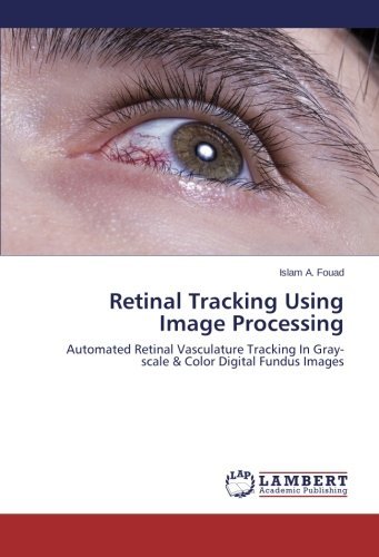 Cover for Islam A. Fouad · Retinal Tracking Using Image Processing: Automated Retinal Vasculature Tracking in Gray-scale &amp; Color Digital Fundus Images (Paperback Book) (2014)