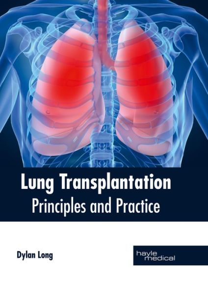 Cover for Dylan Long · Lung Transplantation: Principles and Practice (Gebundenes Buch) (2017)