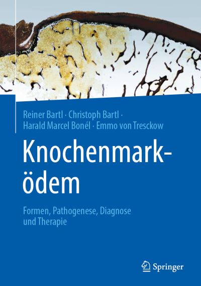 Cover for Reiner Bartl · Knochenmarködem (Book) (2023)