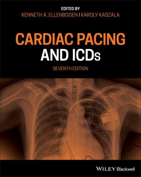 Cardiac Pacing and ICDs - KA Ellenbogen - Kirjat - John Wiley and Sons Ltd - 9781119578338 - torstai 9. heinäkuuta 2020