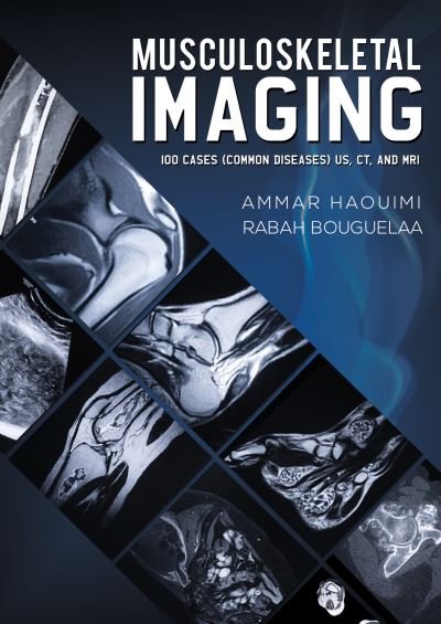Cover for Ammar Haouimi · Musculoskeletal Imaging: 100 Cases (Common Diseases) US, CT and MRI (Pocketbok) (2021)