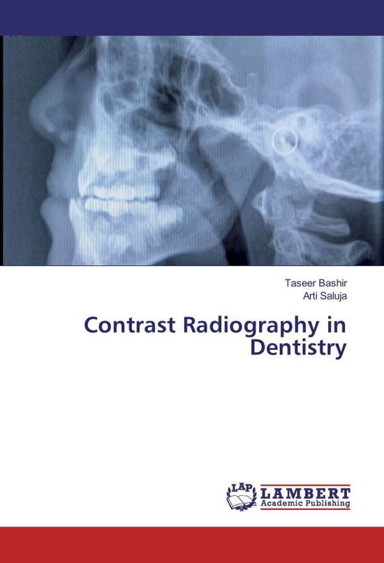 Cover for Bashir · Contrast Radiography in Dentistr (Book)