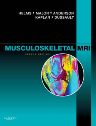 Cover for Clyde A. Helms · Musculoskeletal MRI (Hardcover Book) [2 Revised edition] (2008)