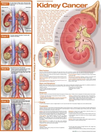 Cover for Anatomical Chart Com · Understanding Kidney Cancer Anatomical Chart (Map) (2022)