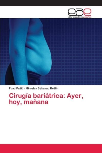 Cover for Pasic · Cirugía bariátrica: Ayer, hoy, ma (Bog) (2020)