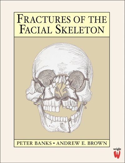 Cover for Peter Banks · Fractures of the Facial Skeleton (Paperback Book) (2000)