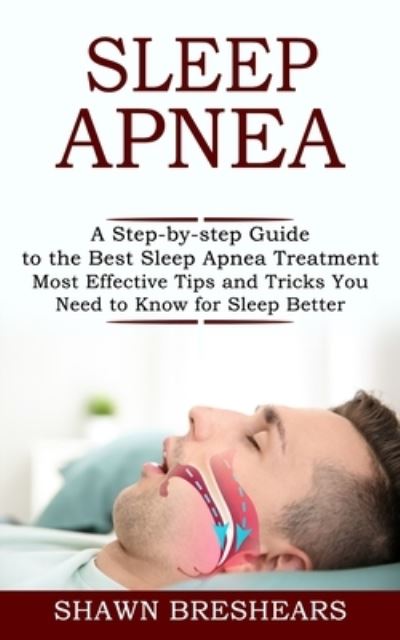 Sleep Apnea - Shawn Breshears - Books - Tomas Edwards - 9781990268342 - February 14, 2021