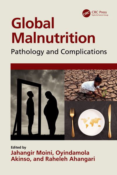 Cover for Jahangir Moini · Global Malnutrition: Pathology and Complications (Innbunden bok) (2023)