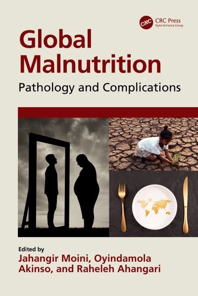 Cover for Jahangir Moini · Global Malnutrition: Pathology and Complications (Gebundenes Buch) (2023)