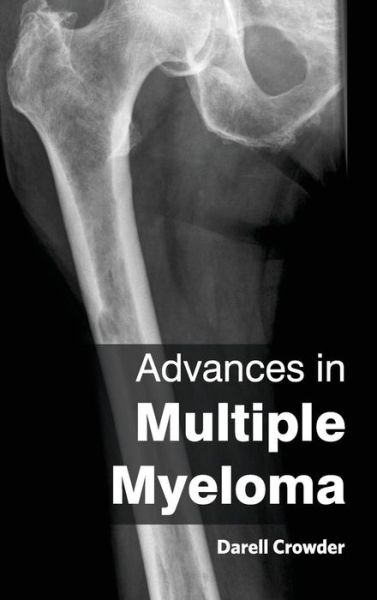 Advances in Multiple Myeloma - Darell Crowder - Books - Foster Academics - 9781632420343 - February 20, 2015
