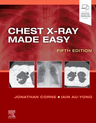 Cover for Corne, Jonathan, MA, PhD, MB BS, FRCP (Consultant Respiratory Physician, Nottingham University Hospitals NHS Trust, Nottingham; Head of the East Midlands Postgraduate Specialty School of Medicine, Health Education, East Midlands, UK) · Chest X-Ray Made Easy - Made Easy (Paperback Book) (2022)