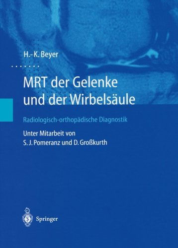 Cover for H.-K. Beyer · MRT der Gelenke und der Wirbelsaule: Radiologisch-orthopadische Diagnostik (Paperback Book) [German, Softcover Reprint of the Original 1st Ed. 2003 edition] (2012)