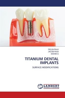 Cover for Delsa Raju · Titanium Dental Implants (Paperback Book) (2021)