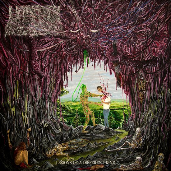 Cover for Undeath · Lesions Of A Different Kind (Splatter Vinyl LP) (LP) (2022)