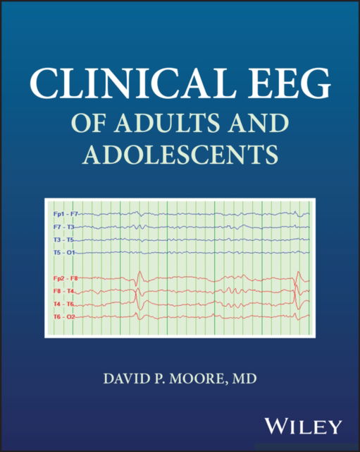 Cover for Moore, David (University of Louisville, KY) · Clinical EEG of Adults and Adolescents (Paperback Book) (2025)