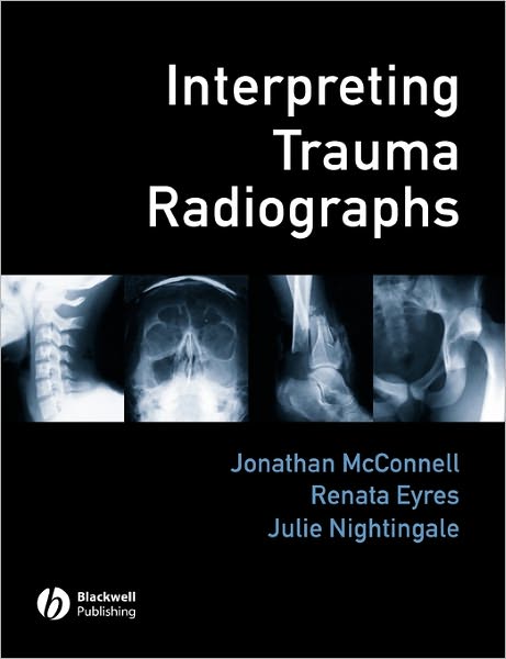 Cover for J McConnell · Interpreting Trauma Radiographs (Paperback Book) (2005)