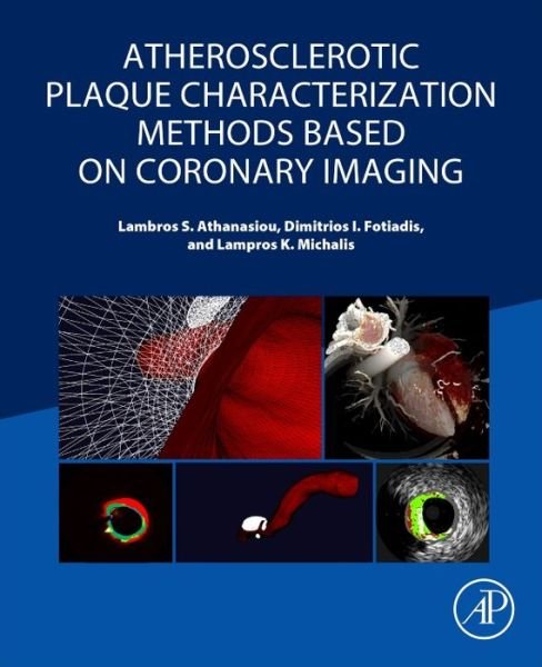 Cover for Athanasiou, Lambros S (Information and Communication Systems Engineer, Institute for Medical Engineering and Science, Massachusetts Institute of Technology, Cambridge, MA, USA) · Atherosclerotic Plaque Characterization Methods Based on Coronary Imaging (Paperback Bog) (2017)