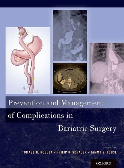 Prevention and Management of Complications in Bariatric Surgery -  - Livros - Oxford University Press Inc - 9780190608347 - 28 de junho de 2018