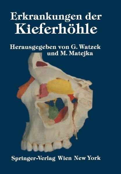 Cover for G Watzek · Erkrankungen Der Kieferhoehle: Symposium, Fuschl, 26.-29. September 1985 (Paperback Book) [Softcover Reprint of the Original 1st 1986 edition] (2012)