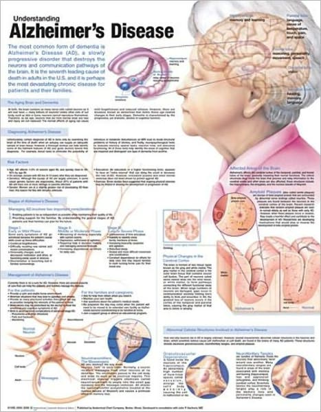 Cover for Anatomical Chart Com · Understanding Alzheimer's Disease Anatomical Chart (Kartor) (2009)