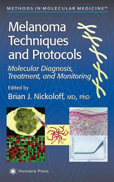 Melanoma Techniques and Protocols: Molecular Diagnosis, Treatment, and Monitoring - Methods in Molecular Medicine - Brian J Nickoloff - Books - Humana Press Inc. - 9781617371349 - December 12, 2011