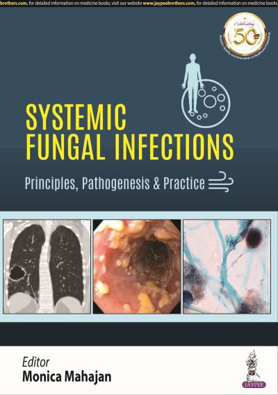 Cover for Monica Mahajan · Systemic Fungal Infections: Principles, Pathogenesis &amp; Practice (Pocketbok) (2019)