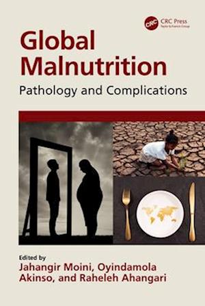 Cover for Moini, Jahangir (Eastern Florida State College, USA) · Global Malnutrition: Pathology and Complications (Paperback Bog) (2025)