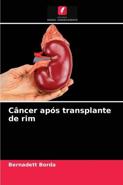 Cover for Bernadett Borda · Cancer apos transplante de rim (Paperback Book) (2021)