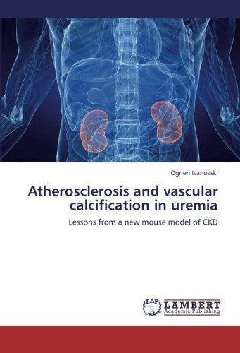 Cover for Ognen Ivanovski · Atherosclerosis and Vascular Calcification in Uremia: Lessons from a New Mouse Model of Ckd (Paperback Bog) (2012)