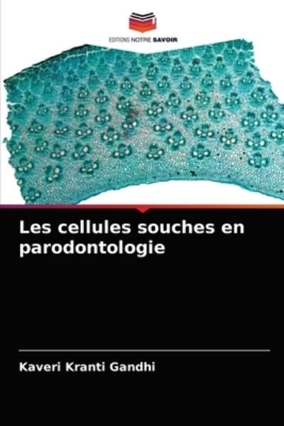 Cover for Kaveri Kranti Gandhi · Les cellules souches en parodontologie (Paperback Book) (2021)