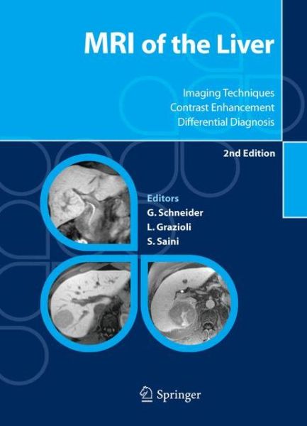 Cover for MRI of the Liver: Imaging Techniques, Contrast Enhancement, Differential Diagnosis (Hardcover Book) [2nd ed. 2006 edition] (2006)