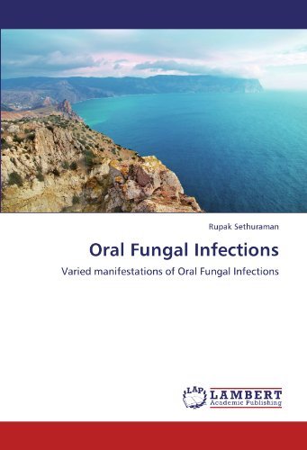 Cover for Rupak Sethuraman · Oral Fungal Infections: Varied Manifestations of Oral Fungal Infections (Pocketbok) (2012)