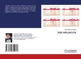 Cover for Upadhyay · Peri-implantitis (Bok)