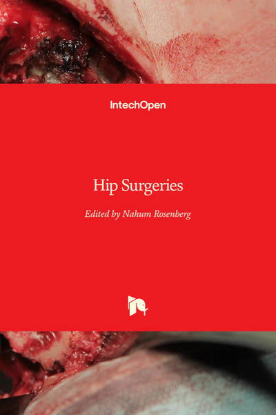 Cover for Nahum Rosenberg · Hip Surgeries (Innbunden bok) (2019)