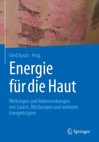 Cover for Energie fuer die Haut (Book) (2018)