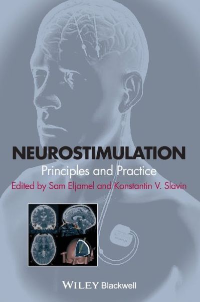 Cover for S Eljamel · Neurostimulation: Principles and Practice (Hardcover Book) (2013)