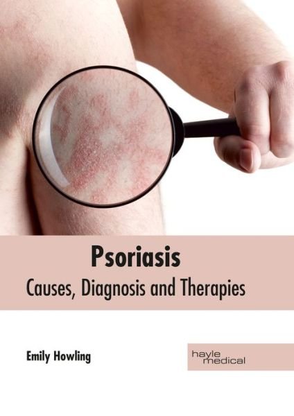 Cover for Emily Howling · Psoriasis: Causes, Diagnosis and Therapies (Gebundenes Buch) (2017)